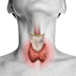 Natura sanat thyroid health formula: a natural solution for optimal thyroid function
